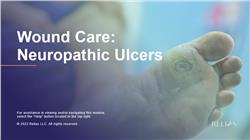 Wound Care: Neuropathic Ulcers